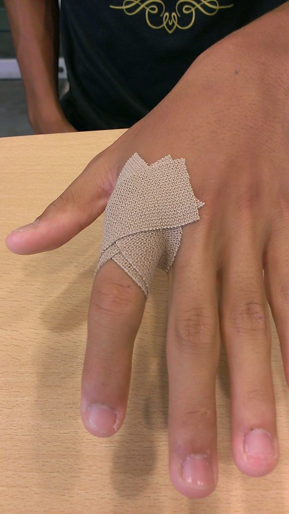 突き指 指の付け根 のテーピング Satukiスポーツトレーナースタジオ長久手さつき接骨院 トレーナーブログ